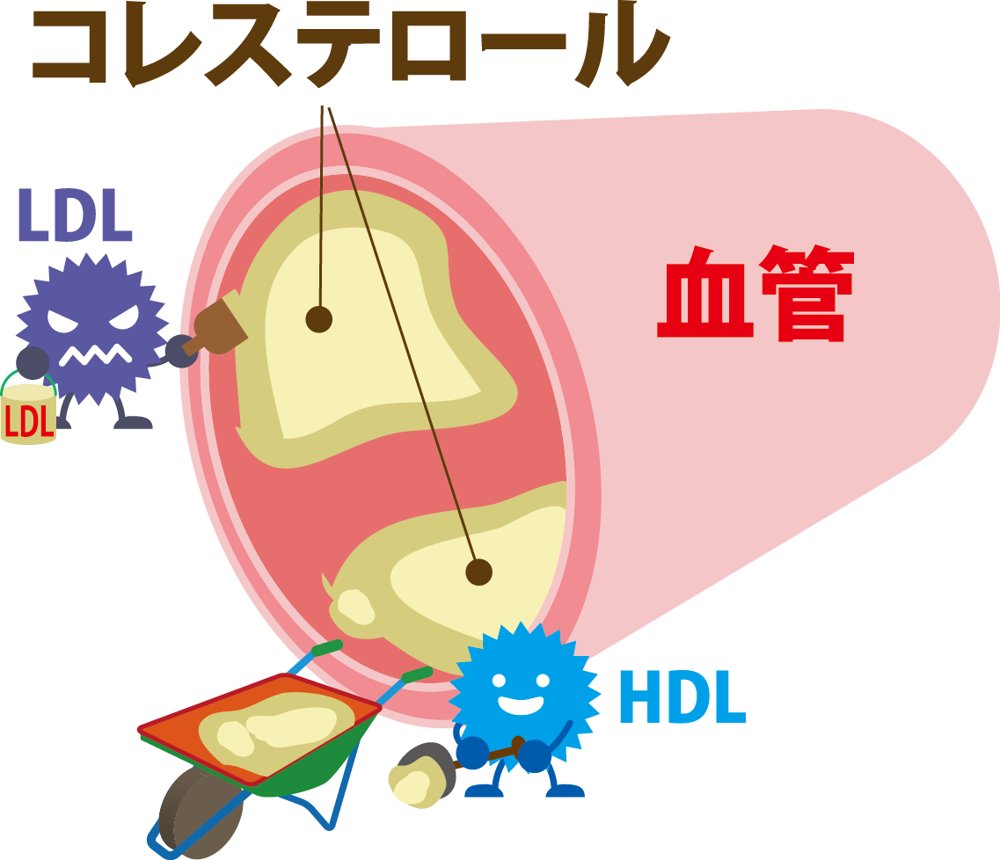 脂質異常症のイメージ